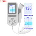Chargeable 3.0MHz Ultrasound Fetal Doppler Baby Heart Beat 0 Radiation Prenata Doppler Baby Heart Rate Monitor Pocket Doppler. 