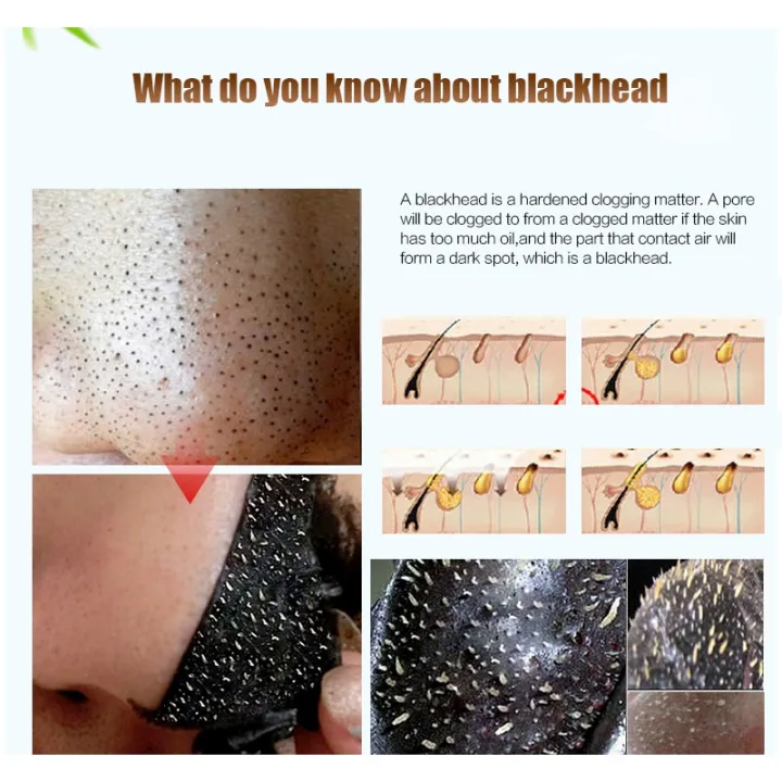 EFERO%20Black%20Head%20Remover%20Mask%20Black%20Face%20Mask%20Acne%20Treatments%20Peel%20Off%20Black%20Mask%20From%20Black%20Dots%20Skin%20Care%203/5/6/10/11packs%20-%20Image%207