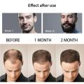 Beard Growth Oil Activator Serum Balm for Facial Hair Regrowth and Thickness for Bearded Men 100% Organic Beard Growth Serum.