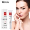 Youbuy Freckle Whitening Cream 20g Pigmentation Remover Dark Spot Remover Anti Freckles Whitening Cream. 