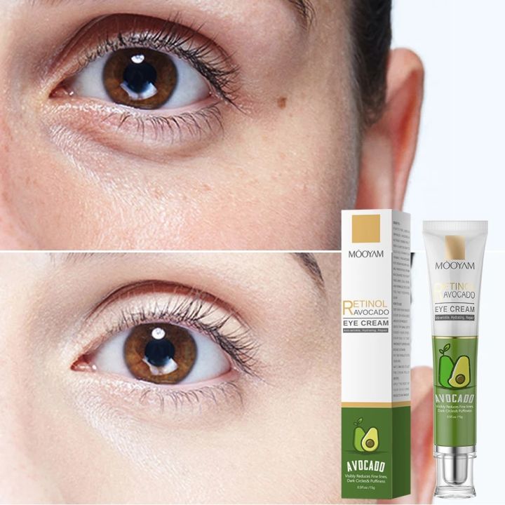 Retinol Eye Cream Dark Circles Remover Anti-Wrinkle Firmness Whitening Under Eyes Serum Skin Care Beauty 15g Abandon Abandon