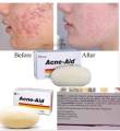 Stiefel Original Acne-Aid Bar 100g Pimple Prone & Oily Skin Acne Aid Soap. 