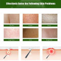 Coarse body hair, removal, cyst removal, Pila, good cream, keratosis, hairy chicken, skin condition, hole modification, dark spots, moisturizing, whitening, smooth skin care. 