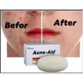 Stiefel Acne-Aid Bar 100g Pimple Prone & Oily Skin Acne Aid Soap. 