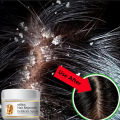 Fast Anti Dandruff Hair Relieve Itching Oil Control Treatment Repair Scalp Cleaning Exfoliating Products Antipruritic Hair Care OutlierO.