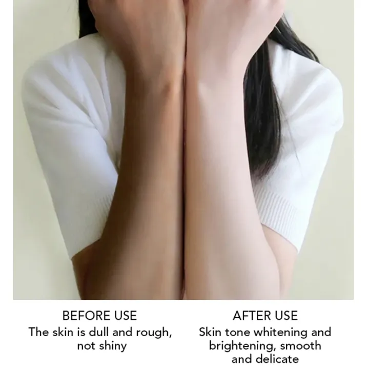 AILKE%20Skin%20Glowing%20Body%20Lotion,%20Moisturizing,%20Soft%20and%20Smooth%20Skin%20Cream,%20With%20Glutathion,%20Vitamin%20C,%20Suitable%20for%20All%20Skin%20Type%20AOutlierA%20-%20Image%204