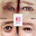 Micro-needle Eye Patch Hyaluronic Remove Dark Circles Eye Bags Improve Puffiness Lift Firm Whitening Moisturizing Skin. 