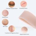 3PC Efficient Surgery Scar Removal Silicone Gel Sheet Therapy Patch for Acne Trauma Burn Scar Skin Repair Scar Treatment. 