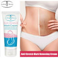Radiant Skin Anti-Stretch Mark Miracle Cream - 60gm Enriched with Natural Ingredients for Ultimate Skin Renewal. 