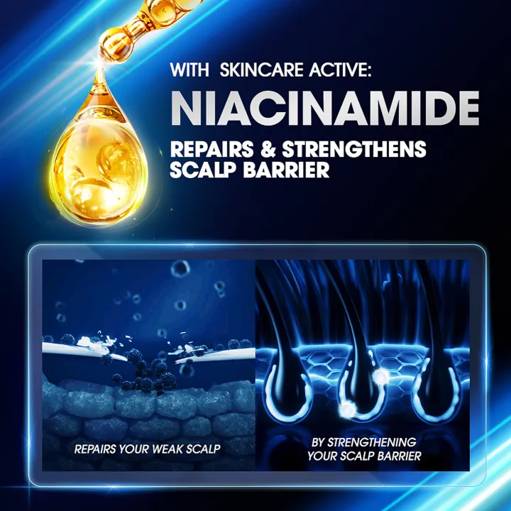 Clear%20Shampoo%20Complete%20Active%20Care%20Anti%20Dandruff%20170ml%20-%20Image%206