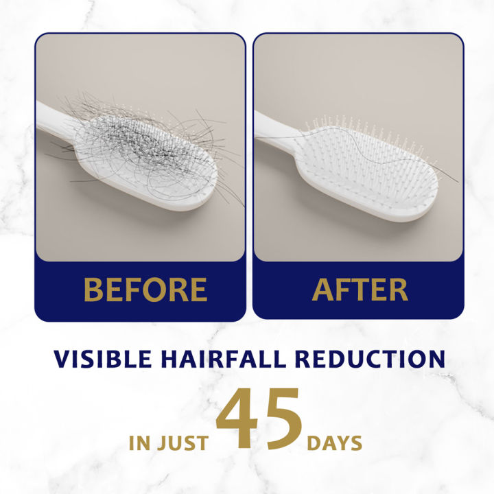 ANTI%20HAIR-FALL%20BUNDLE%20-%20Parachute%20Anti%20Hairfall%20Oil%20Extra%20Care%20150ml%20(Root%20Applier)%20&%20Parachute%20Naturale%20Shampoo%20Advanced%20Hair%20Fall%20Control%20160ml%20-%20Image%206