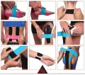Kinesiology Sports Taping. 