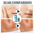 50ml Scar Removal Cream Gel Burn Surgical Scar Cesarean Scar Repairing cream Repair Burns Scalding Surgery Stretch cream. 