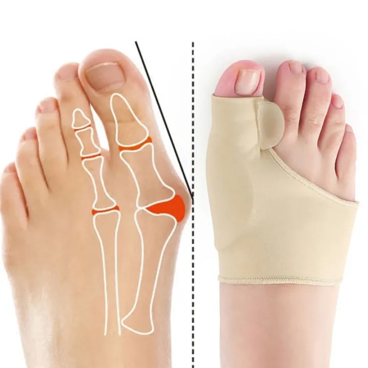 Bunion%20Corrector%20Big%20Toe%20Separator%20Foot%20Pad%20Cushion%20Heel%20Protector%20Insoles%20Valgus%20for%20Toe%20Finger%20Separator%20Feet%20Straightener%20-%20Image%202