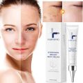 Dark Spot Corrector Cream Skin Whitening Fade Lightening Blemish Serum Reduces Age Spots Freckles Removal Face Day Cream 20g.