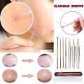 Blackhead Treatment Tool set 4pcs Cleaning Tools set. 