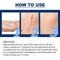 ELHOE Scar Removal Cream Gel Burn Surgical Scar Cesarean Scar Repairing Stretch Marks Pigmentation Corrector.