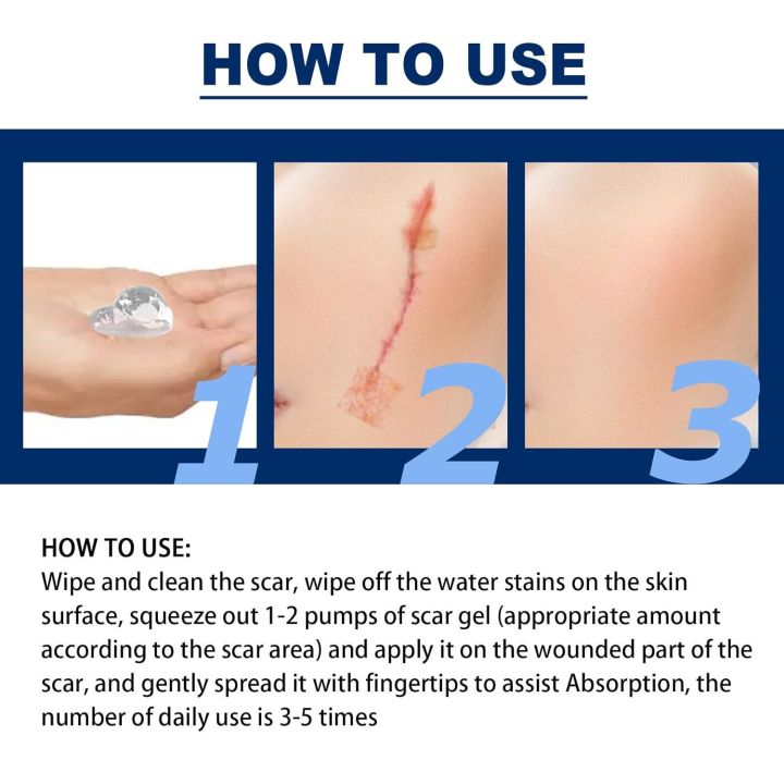 ELHOE%20Scar%20Removal%20Cream%20Gel%20Burn%20Surgical%20Scar%20Cesarean%20Scar%20Repairing%20Stretch%20Marks%20Pigmentation%20Corrector%20-%20Image%205