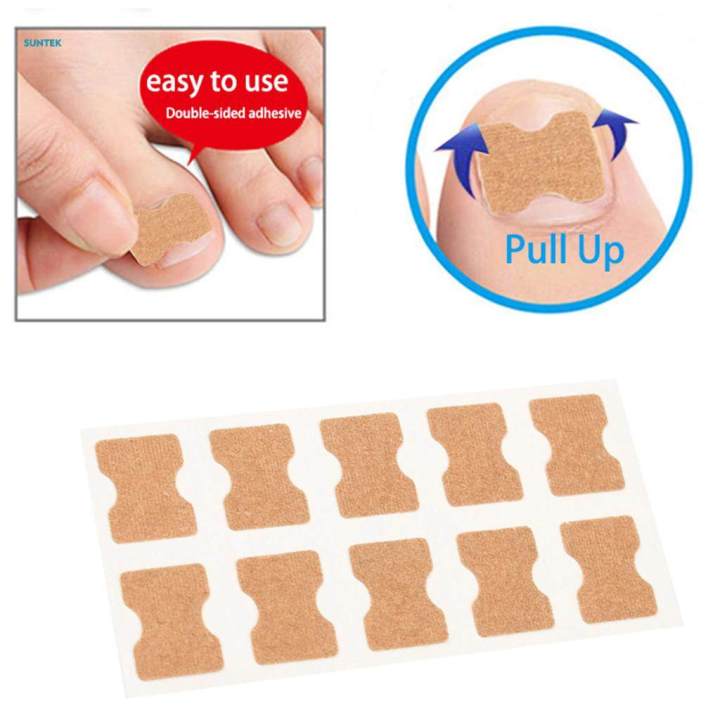 %E3%80%90Top-rated%E3%80%91%20Toenail%20Corrector%20Stickers,%20Toe%20Nail%20Treatment%20Toe%20Nail%20Care%20Correction%20Tool%20-%2050%20Sheets%20-%20Image%203