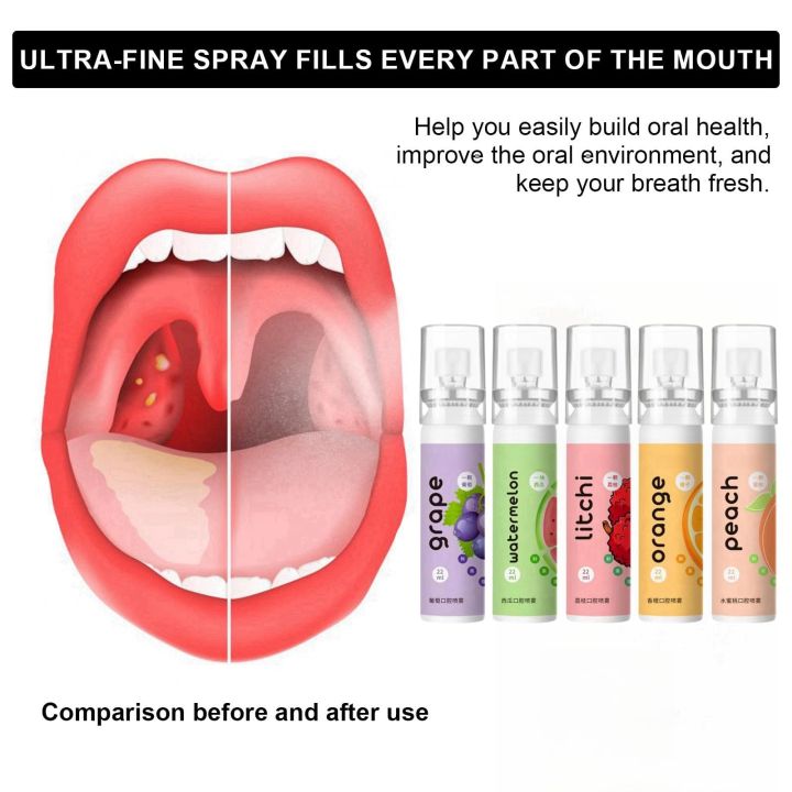 Oral%20Fresh%20Spray%20Mouth%20Freshener%206%20Smell%20Fresh%20Breath%20Mouth%20Fruit%20Litchi%20Peach%20Grape%20Flavor%20Persistent%20Portable%20Oral%20Care%20-%20Image%203