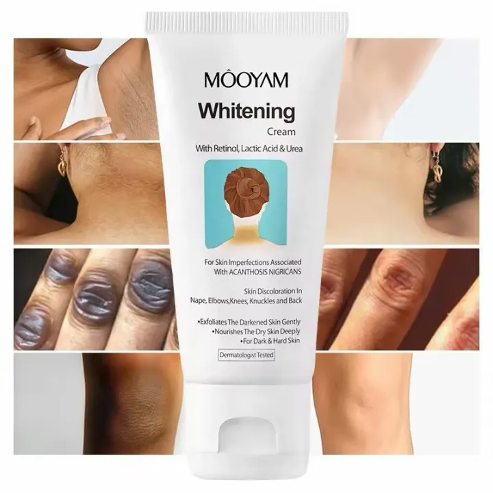 Skin%20Whitening%20Cream%20with%20Retinol,%20Body%20and%20Intimate%20Area,%20Armpits,%20Arms,%20Knees,%20Elbows,%20Nourishing%20and%20Flashing%20Body%20and%20Neck%20Cream,%20Natural%20Corrector%20for%20Dark%20Spots%20for%20Private%20-%20Image%203