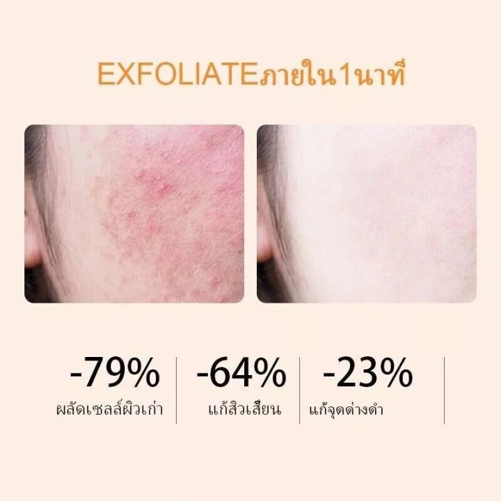 Gmeelan%20Orange%20Extract%20Gel%20Exfoliating%20Facial%20Acne%20look%20bright%20Body%20Scrub%20-%20Image%208