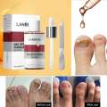 LANBENA Nail Repair Essence Serum 15ml – Effective Nail Fungus & Damage.