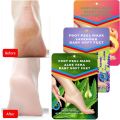 Exfoliating Foot Peeling Mask1 Pair/2PCS Pedicure Socks Scrub For Repair Dead Skin Remove Peel Off Care Korean Cosmetic 40Ml. 