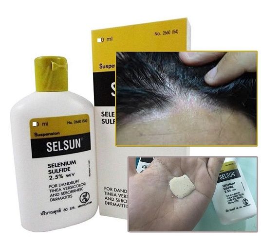 Selsun%20Selenium%20Sulfide%202.5%25%20Dandruff%20Shampoo%20-%20120ml(Made%20in%20Thailand)%20-%20Image%203