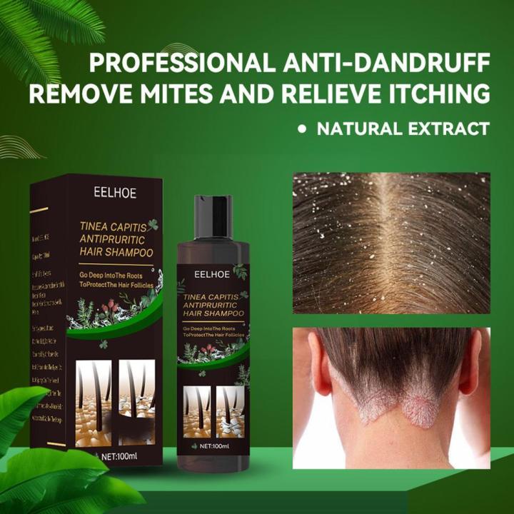 EELHOE%20100ml%20Tinea%20Dispelling%20Anti-itching%20Shampoo%20Anti-dandruff%20Shampoo%20Hair%20Shampoo%20Treatment%20Oil%20Refreshing%20Control%20-%20Image%202