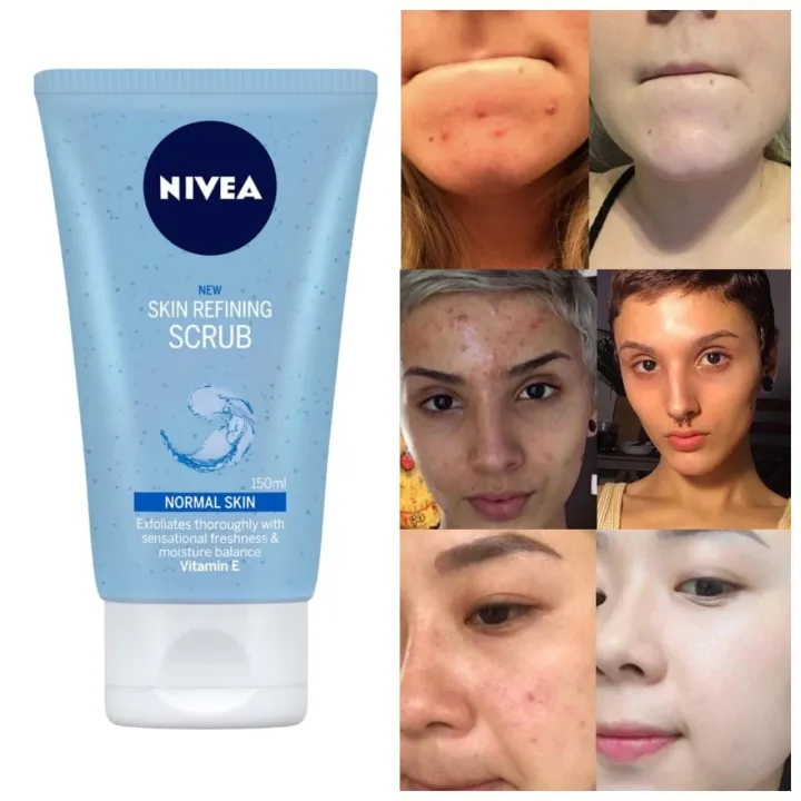 NIVEA%20Skin%20Refining%20Scrub%20-%20Image%204