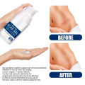 EELHOE Scar Removal Cream Gel Burn Surgical Scar Cesarean Scar Repairing Stretch Marks Pigmentation Corrector. 