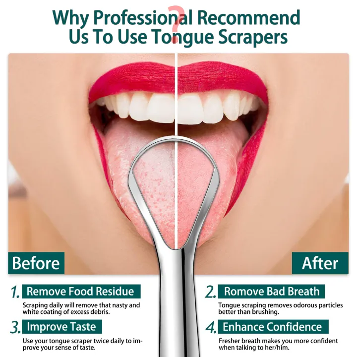 %E3%80%90Lejia%E3%80%913%20PCS%20Tongue%20Scrapers%20with%20Metal%20Case,%20Tongue%20Scraper%20Kit%20for%20Kids%20Premium%20Metal%20Tongue%20Scraper%20Cleaner%20Great%20for%20Oral%20Hygiene%20Bad%20-%20Image%203