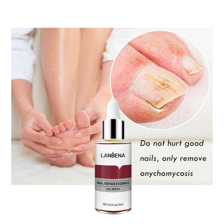LANBENA%20Nail%20Repair%20Essence%20Serum%20-%2012ml%20-%20Image%202