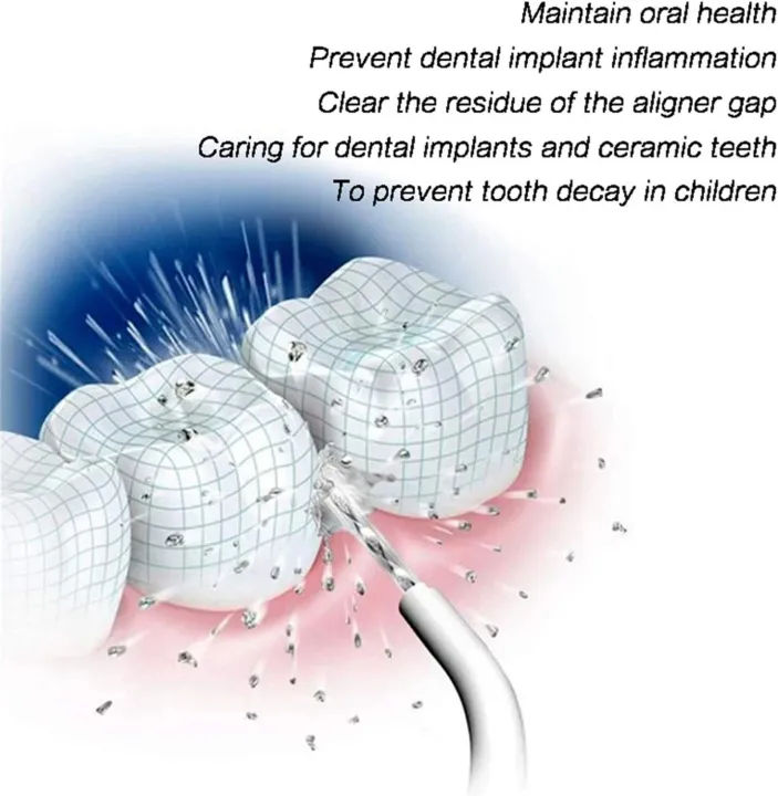 Oral%20Power%20Floss%20%E2%80%93%20Cordless%20Dental%20Water%20Jet%20Tooth%20Flosser%20%E2%80%93%20No%20Battery/Charging%20Needed%20%E2%80%93%20Deep%20Clean%20for%20Braces,%20Crowns,%20Gums%20%E2%80%93%20Travel%20Friendly%20-%20Image%204