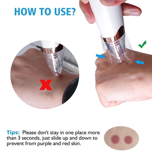 Electric%20Vacuum%20Electric%20Acne%20/%20Blackhead%20Remover%20Extractor%206%20Suction%20Head%20Beauty%20Machine%20-%20Black%20Head%20Remover%20-%20Image%207