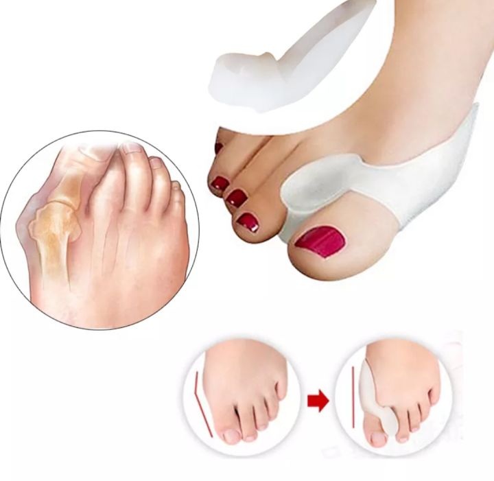 Big%20Toe%20Separator%20Bone%20Corrector%20Straightener%20Silicone%20Gel%20Foot%20Fingers%20Protector%20Bunion%20Adjuster%20Feet%20Massager%20with%20Carryability%20-%20Image%204