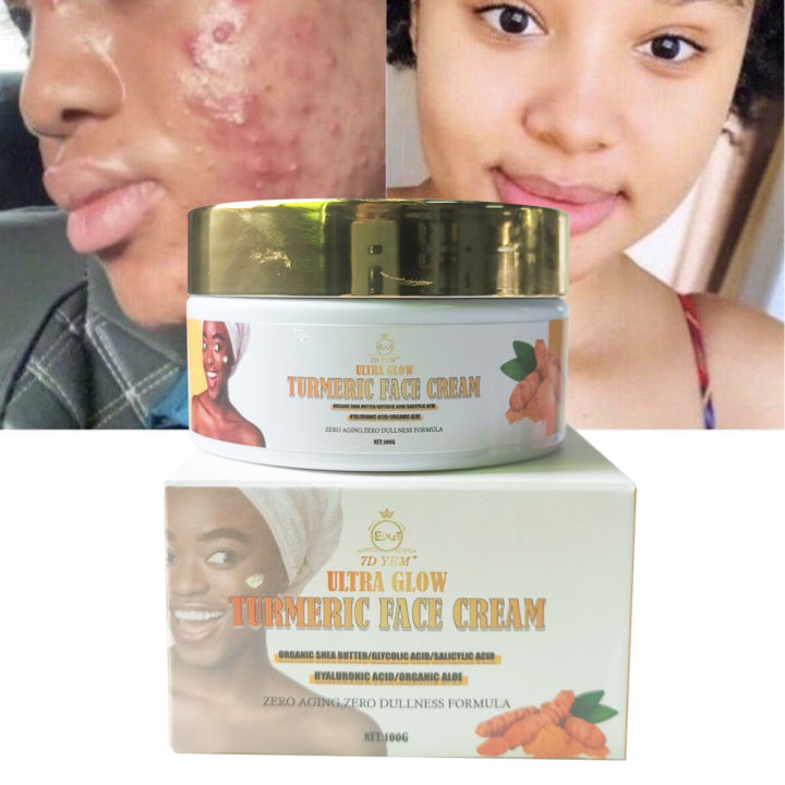 Natural aloe Vera Essence Whitening Moisturizing and hydrating acne treatment skin cream Glutathione Whitening Turmeric Cream