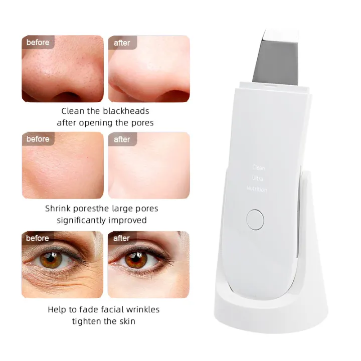 Ultrasonic%20Face%20Scraper%20Facial%20Lifting%20Firming%20Scraper%20Blackheads%20Exfoliation%20Dead%20Skin%20Cleansing%20Spatula%20Home%20Skin%20Care%20Tools%20-%20Image%202