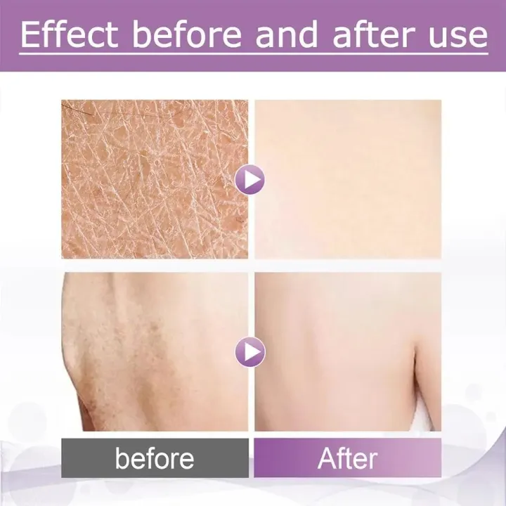 56.7g%20Essence%20Exfoliator%20Gel%20Facial%20Scrub%20Face%20Peeling%20Skin%20Arm%20Cream%20Face%20Smooth%20Knee%20Leg%20Body%20Care%20Whitening%20Scrub%20Repair%20R6J8%20-%20Image%204