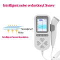 Chargeable 3.0MHz Ultrasound Fetal Doppler Baby Heart Beat 0 Radiation Prenata Doppler Baby Heart Rate Monitor Pocket Doppler. 
