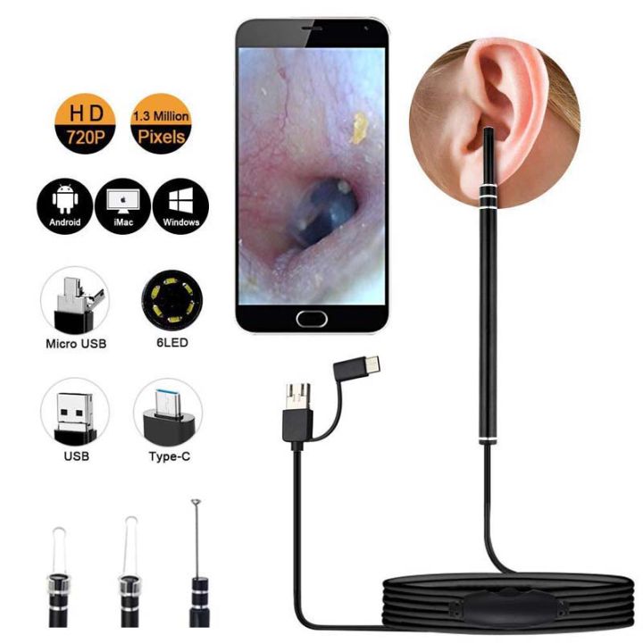 Ear%20Cleaning%20Camera%20Otoscope,%20Endoscope,%203%20in%201%20Ear%20Wax%20Removal%20-%20Image%206