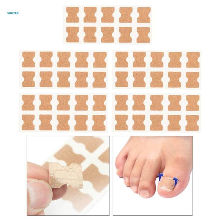 %E3%80%90Top-rated%E3%80%91%20Toenail%20Corrector%20Stickers,%20Toe%20Nail%20Treatment%20Toe%20Nail%20Care%20Correction%20Tool%20-%2050%20Sheets%20-%20Image%205