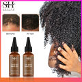 Sevich Africa Hair Growth Oil 30ml Traction Alopecia Chebe Powder Essence Oil Anti Hair Loss Treatment Product Thicken Hair Care AOutlierA.