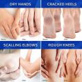 Urea Cream 42% Plus Salicylic Acid 4 Oz, Upgraded Callus Remover Hand Cream Foot Cream for Dry Cracked Feet, Hands,. 