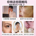 Beijing Tong Ren Tang Vitamin C Plus Vitamin E Niacinamide Tablets Source Manufacturers Wholesale Vitamin C Vitamin E.