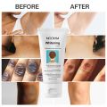 Skin Whitening Cream with Retinol, Body and Intimate Area, Armpits, Arms, Knees, Elbows, Nourishing and Flashing Body and Neck Cream, Natural Corrector for Dark Spots for Private. 