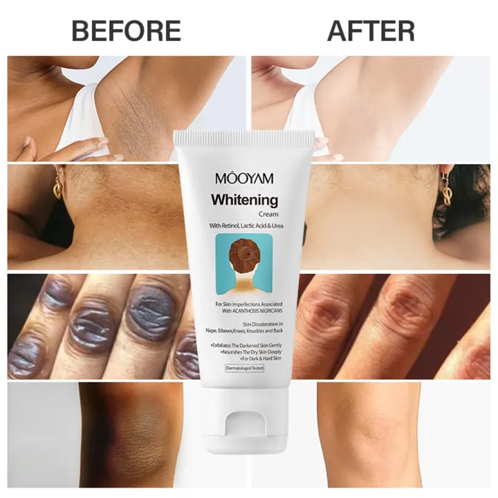 Skin%20Whitening%20Cream%20with%20Retinol,%20Body%20and%20Intimate%20Area,%20Armpits,%20Arms,%20Knees,%20Elbows,%20Nourishing%20and%20Flashing%20Body%20and%20Neck%20Cream,%20Natural%20Corrector%20for%20Dark%20Spots%20for%20Private%20-%20Image%207