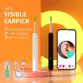 Bright, Clear, and Gentle – Smart Visual Ear Cleaner with HD Camera – Safe, Precise & Rechargeable Ear Care Solution - Safe, Precise & Hygienic Ear Cleaning. 