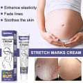 Stretch Marks Permanent Removal Cream Eliminate Body Belly Stretch Marks Swelling Marks Remove Skin Cracks. 